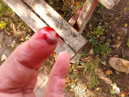 2016.11.August: 16.20 And... SMASH! No real pain but BLOOD!